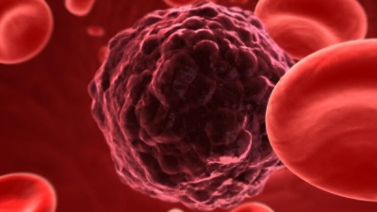 cancer diagnosis
