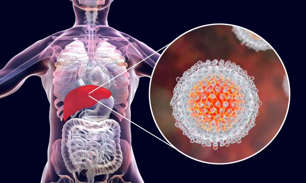 How Does Hepatitis C Become Chronic?