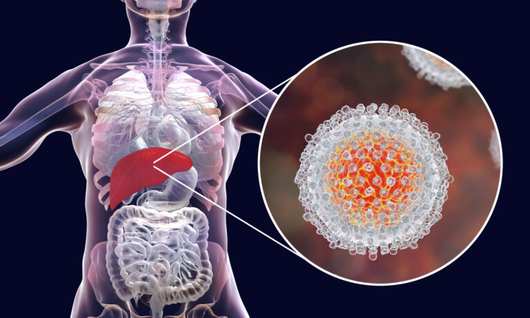 How Does Hepatitis C Become Chronic?