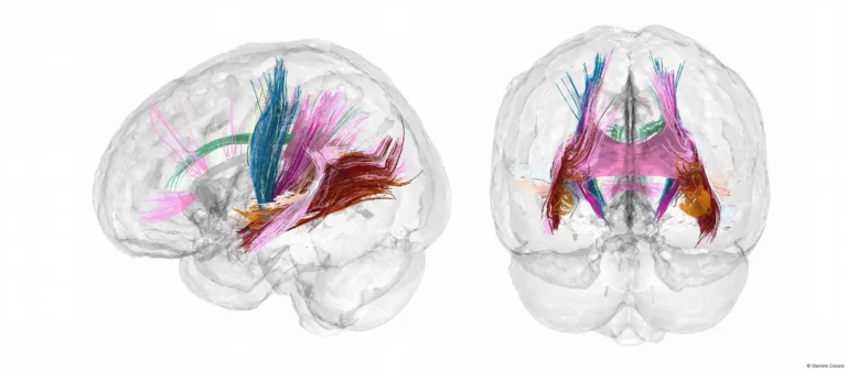 Pregnancy Completely Rewires Mothers' Brains