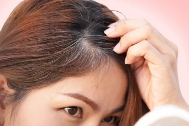 Gray Hairs