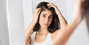 What is Dandruff Really