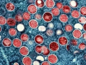 Second Monkeypox Case of the Year Reported in KP
