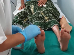 Most Cases of Foot Amputations Due to Diabetes