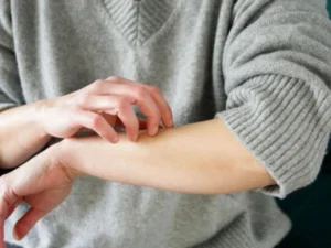 Why Do We Itch